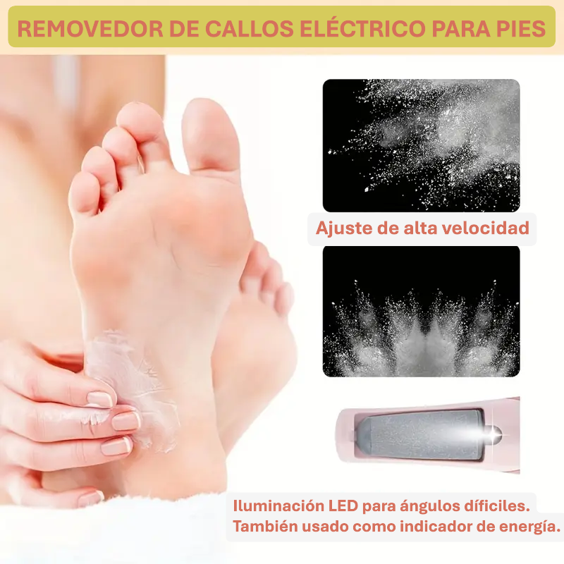 REMOVEDOR DE CALLOS